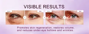 Before and after results showing eye balm reducing under-eye wrinkles and hollows