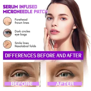 Patch microneedling al siero per borse e rughe, effetto prima e dopo