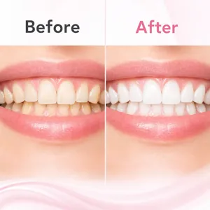 Teeth whitening comparison showing before and after results of dental repair essence
