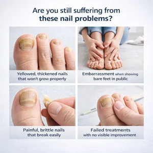 Vue détaillée des ongles jaunis et cassants pour une solution de traitement fongique efficace