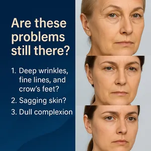 Detailed comparison showing visible reduction of deep facial wrinkles and fine lines.