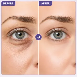 Instant lifting eye cream gel before and after comparison showing reduced eye bags