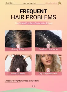 Dettagli dei problemi ai capelli come forfora e cuoio capelluto grasso per la cura