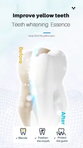 Comparación detallada que muestra el efecto de blanqueamiento dental antes y después