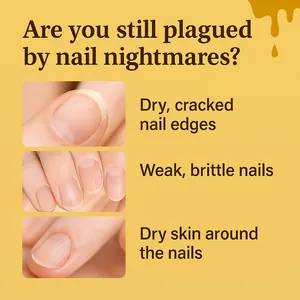 Detail showing dry, cracked, and brittle nails before treatment with organic nail oil.