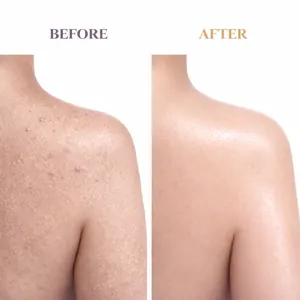 Comparaison détaillée de la texture de peau avant et après gommage au sel marin
