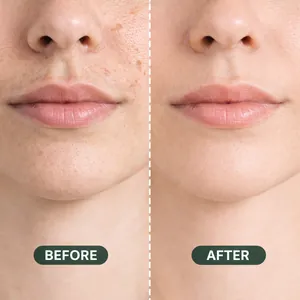 Before and after comparison of facial skin treatment results with Cyperus Rotundus Oil