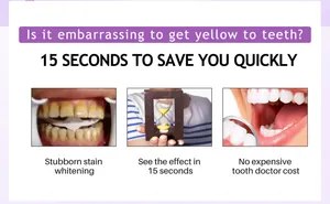 Eficacia de la espuma blanqueadora de dientes V34 para eliminar manchas amarillas rápido