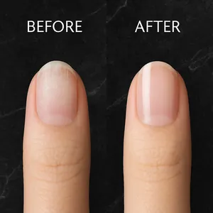 Before and after comparison showing the effective results of nail glue remover treatment