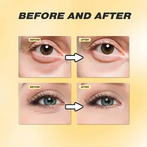 Detailed before and after comparison of eye cream effect on wrinkles and bags