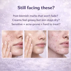 Representación visual de marcas post-imperfecciones y problemas de acné sensible.