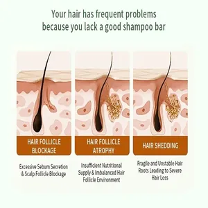 Diagramm zur Erklärung von Haarfollikelblockaden und Haarausfall für festes Shampoo.