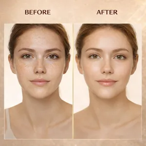 Before and after comparison of skin clearing effect with vitamin glow filter cream
