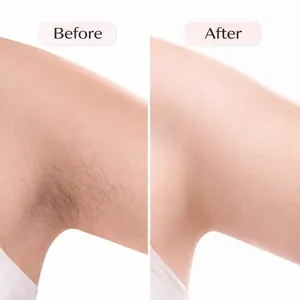 Visual comparison of underarm hair removal results before and after using Cyperus Rotundus Oil.