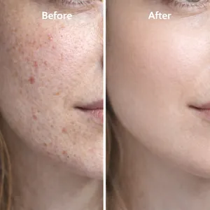 Detail view showing before and after skin repair with blue copper peptide essence