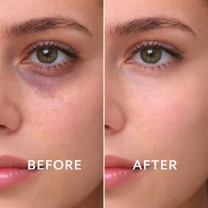 Niacinamide eye care essence showing before and after results for dark circles.