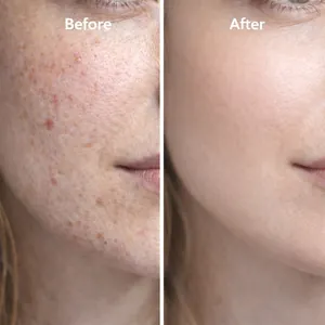Blue Copper Peptide serum for facial skin repair showing clear before and after results