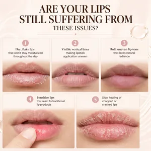 Infografik zu Lippenproblemen wie Trockenheit, Fältchen und ungleichmäßigem Ton.