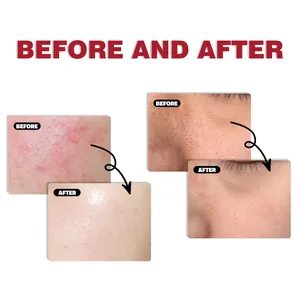 Detailed before and after skin comparison showing the effects of organic grass-fed tallow cream