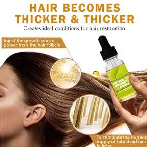 Detailansicht von 30 ml Haarwuchsserum mit 15 % Minoxidil und Haarfollikel-Regeneration