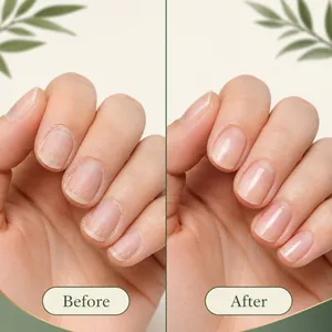 Before and after visual results of using tea tree ginger nail repair essential oil serum