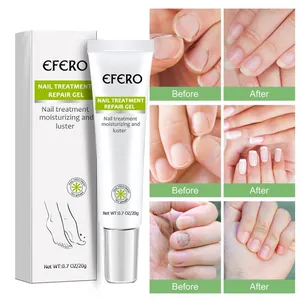 Vue détaillée de l'amélioration des ongles après l'utilisation du gel traitant EFERO
