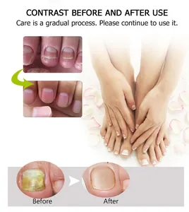 Comparaison détaillée des résultats de la crème réparatrice pour des ongles sains