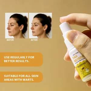 Comparación detallada antes y después del spray de veneno de abeja para eliminar verrugas