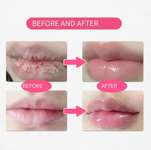 Risultati prima e dopo che mostrano l'effetto riparatore del balsamo labbra Glow Gloss SPF 40.