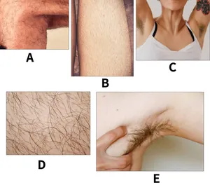 Detailed view of body hair on different areas for hair removal spray application
