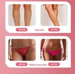 Before and after results showing leg and bikini area hair removal with hair removal cream