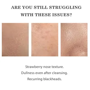 Close-up of common skin concerns like blackheads and dullness for exfoliating ampoule.