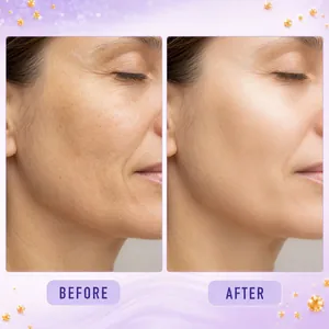 Comparison of skin texture before and after using Retinol Retinal 2000 NAD+ Serum.