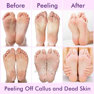 Comparación detallada de los resultados antes y después de una mascarilla exfoliante