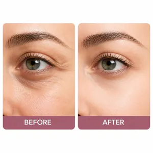 Comparación visual antes y después de la reducción de arrugas bajo los ojos con retinol