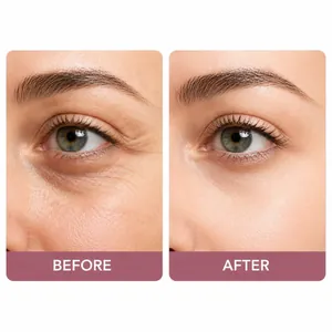 Comparación visual de antes y después del suero de retinol para ojos, arrugas y firmeza