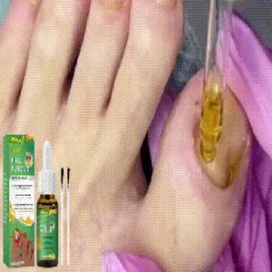 Nahaufnahme von Bienengift-Nagelpilz-Behandlungsserum mit professionellen Applikator-Pinseln