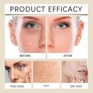 EELHOE wild yam repair cream before and after results for spots and fine lines