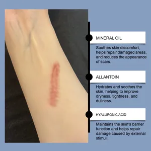 Detailed infographic of skin care cream showing scar repair ingredients and benefits