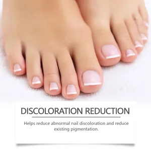 Detailed view showing healthy toenails after nail discoloration reduction treatment