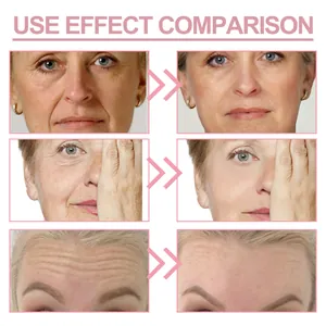 Comparación del efecto de la crema para ojos en líneas finas y arrugas del rostro.