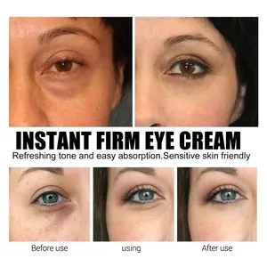 Comparison showing reduced eye wrinkles before and after using firming eye cream