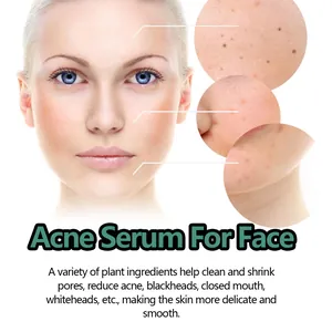 Vista dettagliata degli effetti del siero antiacne sulla pelle con pori ridotti