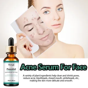 Siero anti-acne Hoygi per il viso con ingredienti vegetali per una pelle liscia e pulita