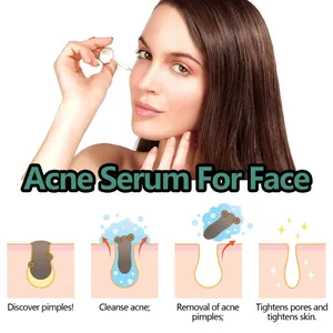 Diagramma dettagliato del siero acne che mostra la pulizia dei pori e il rassodamento