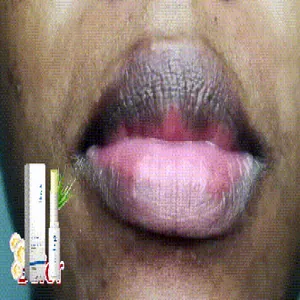 Macro-opname van lippen met Hoygi hydraterende lippenbalsem en productverpakking