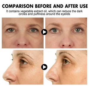Detailed before and after comparison for eye cream reducing dark circles and puffiness