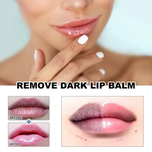 Voor en na vergelijking van de hydraterende Hoygi lippenbalsem voor donkere lippen