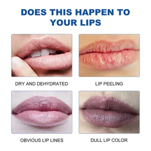 Visuele gids voor lipproblemen zoals droogheid voor lipverzorgingsbehandeling.