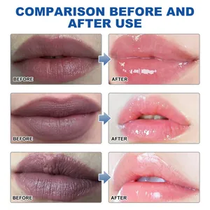 Vergelijking van lippenbalsem-effect met gehydrateerde en volle lippen voor en na.